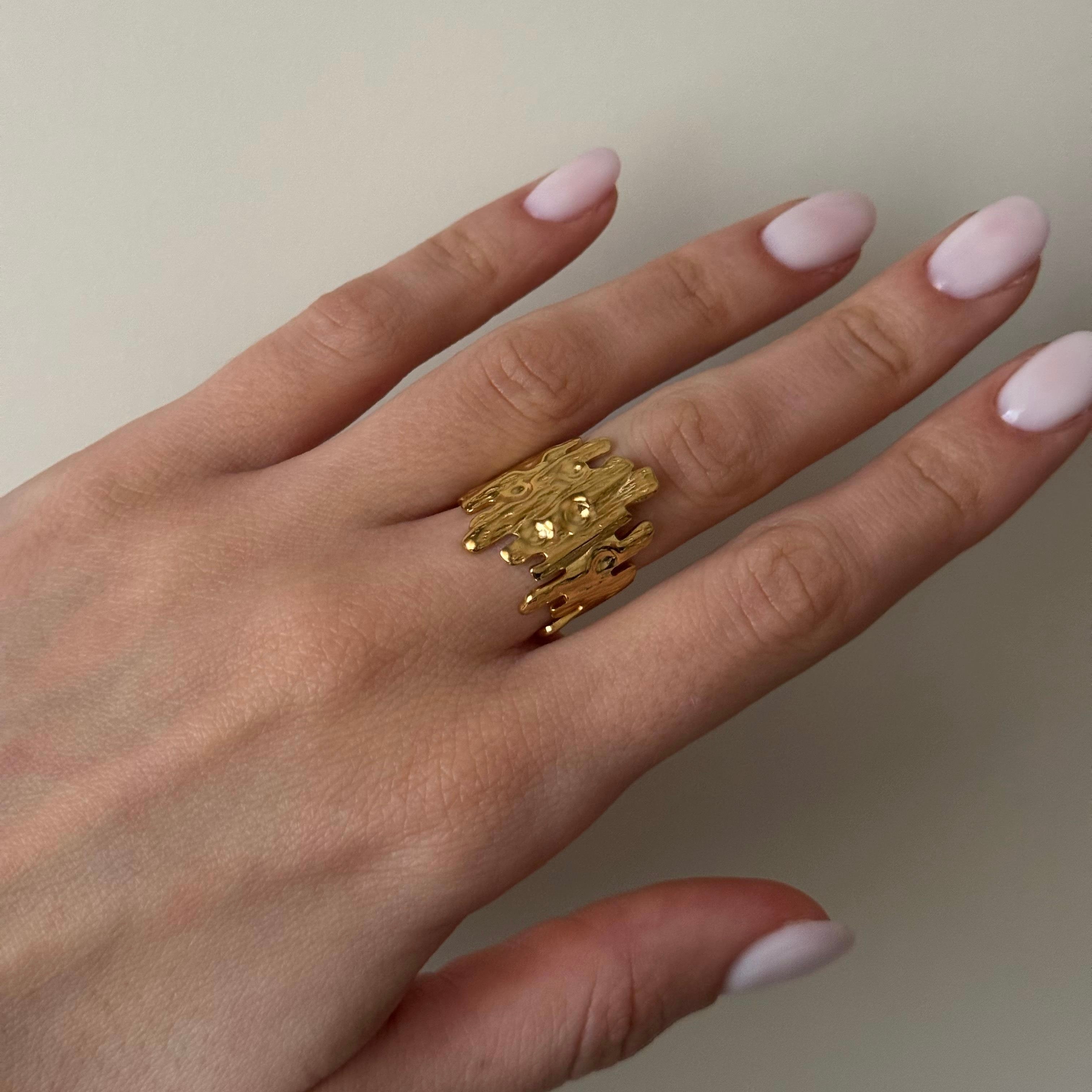 ANELLO KESSIE